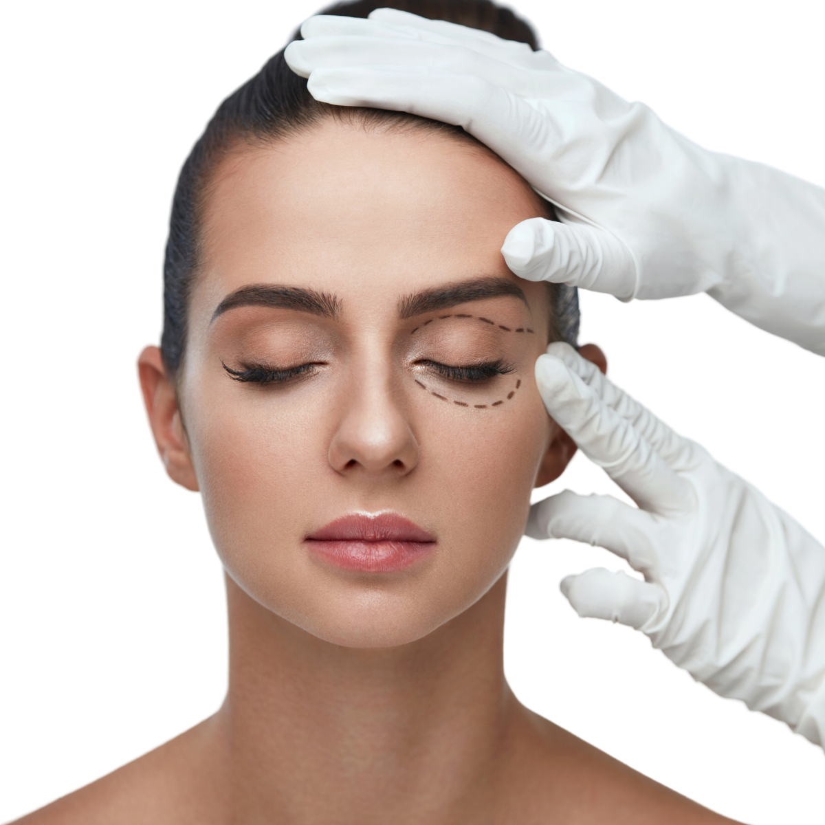 SB Eyelift & Eyebag Removal