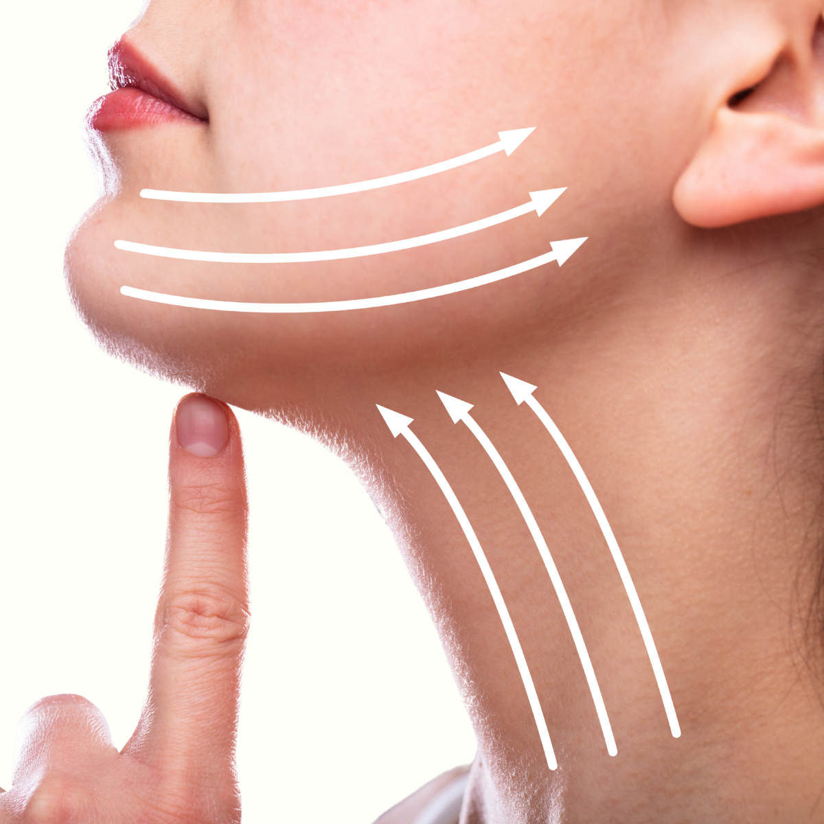 SB Face Lift/Neck Lift